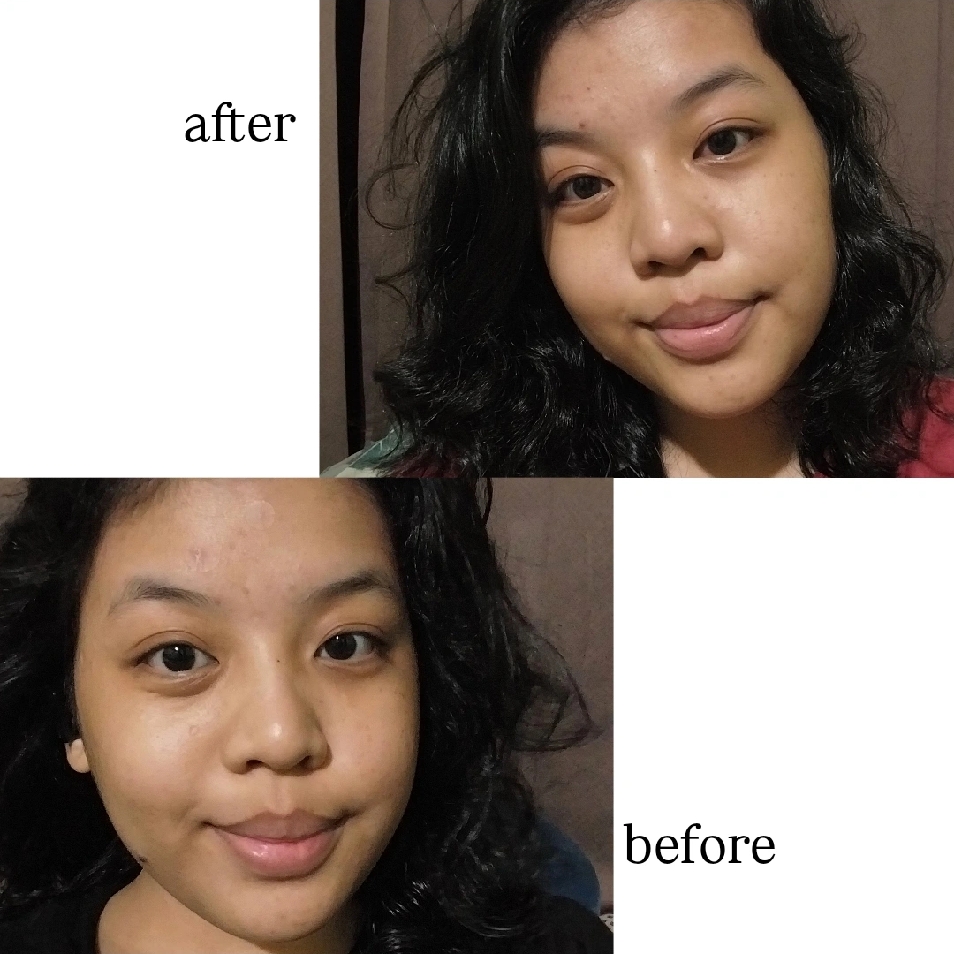 Ultimate Vibrant Skin imgfdn-1f34c8ba-15d8-449a-8faf-38fe87d20274