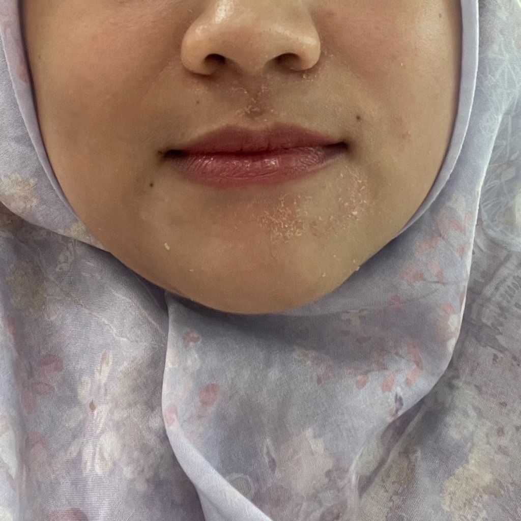 Ceramide Ato Concentrate Moisturizer Cream imgfdn-c50f8bc7-1981-42e7-b8bb-8248c6850023