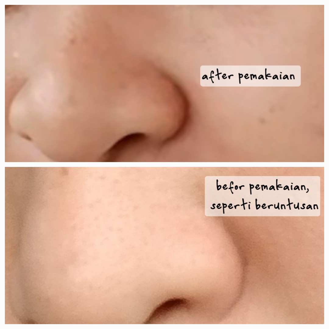 Radiant Resurfacing Retinal Cysteamine Serum imgfdn-0590c827-e4d9-4223-929f-d1a1c8329caf