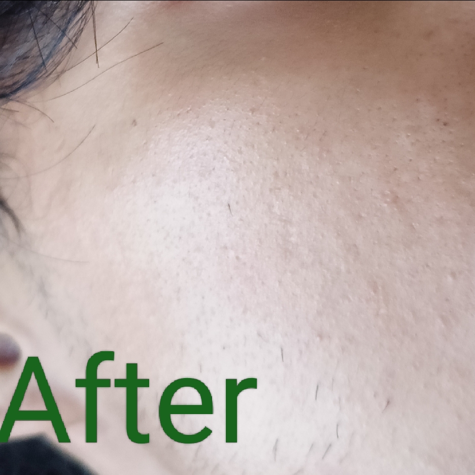 BiomeRepair™ Barrier Revive Cream imgfdn-af1b61c0-75b3-4a96-80cd-a81cea893bb7