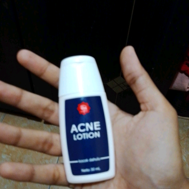 Acne Lotion imgfdn-c9b641a5-8e4c-48a4-9007-48fd78f99560