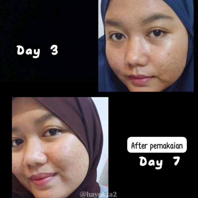 Recombinant Collagen Gel Moisturizer imgfdn-ab105e8c-5b92-4a8a-9921-bf2916f3696d