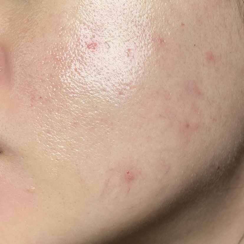 Skin Ready Hydrating Booster imgfdn-8339621c-8a63-4630-8e36-7937a139e780