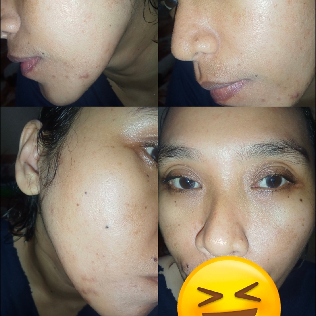 Hyd-rice-ing & Brightening Essence Booster imgfdn-9dae59c4-ea9f-44e3-9ed4-63efe241fac3