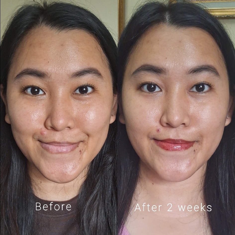 Age Miracle Ultimate Youth Serum imgfdn-122e799b-cddf-4f5d-b1b4-03075d3c355d