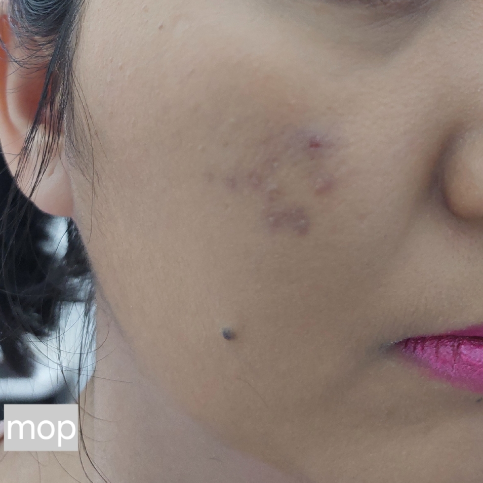 SO X-TRA! Peptides Sunscreen Foundation - MW1 imgfdn-a49b819c-bc40-4db5-bef8-be25afef6bac