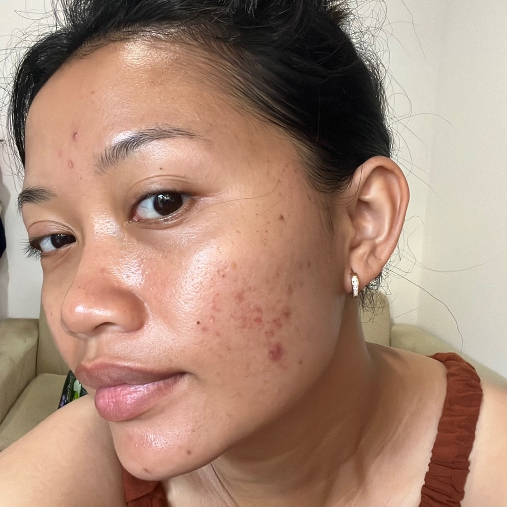 AHA BHA PHA 30 Days Miracle Cream imgfdn-52ccbeeb-92f4-4e41-8da0-4d088bddbba5