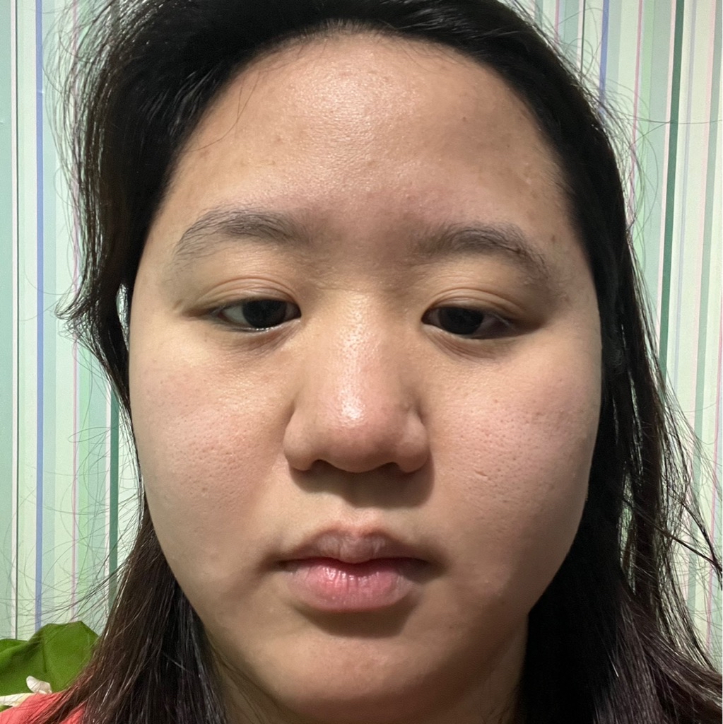 Ultimate Vibrant Skin imgfdn-94a0fe5c-9a13-4517-a131-0e2e9f0a71b1