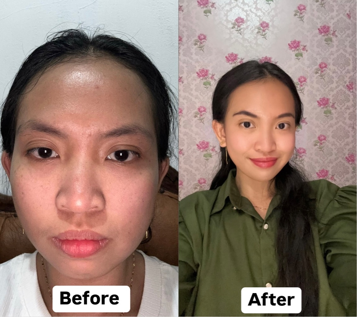 Recombinant Collagen Gel Moisturizer imgfdn-d0430b7a-04b3-4afe-a7aa-39a4a2d6aad0