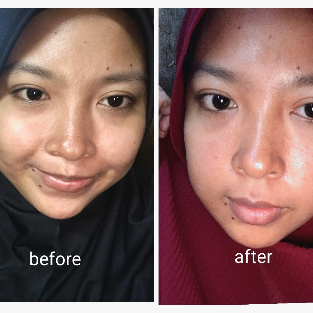 Recombinant Collagen Gel Moisturizer imgfdn-a6fd83f5-71a8-422f-ae1f-22d3b7015fad