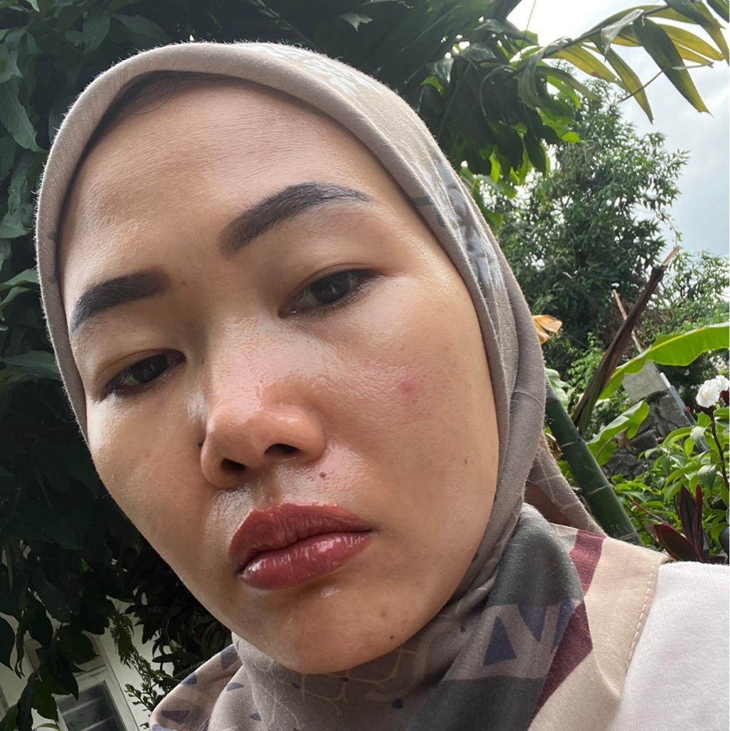 Salicylic Acid Toner 2% with Succinic Acid imgfdn-7b7e611f-0b09-4e70-b4cd-f4773c0f413a