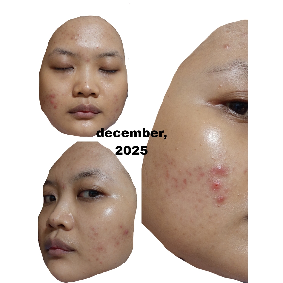 Ultimate Vibrant Skin imgfdn-71ff99e7-e832-4332-a56c-1cceb18ce0f4