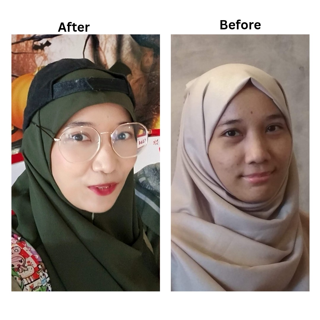 Radiant Resurfacing Retinal Cysteamine Serum imgfdn-6cea41f0-d7b9-4ae1-91ef-d2ee661c3b2f