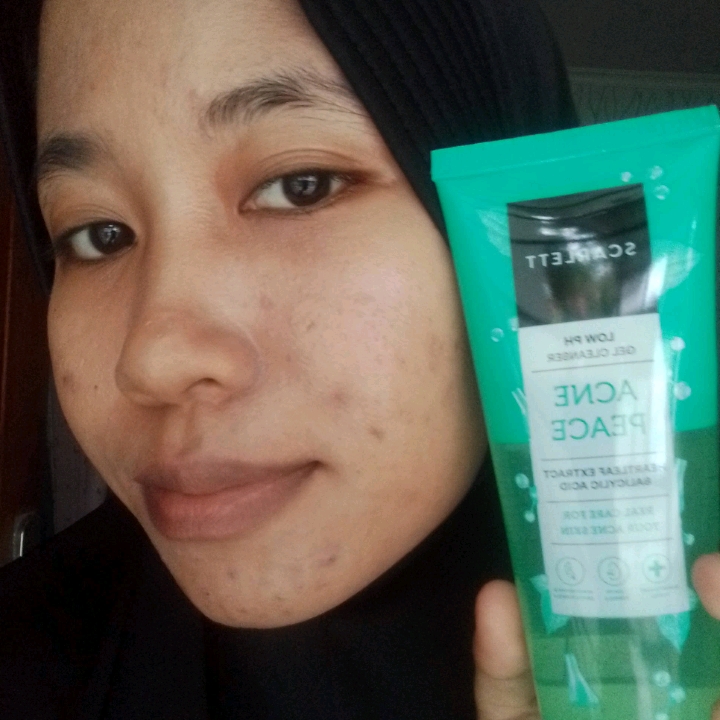 Low pH Acne Peace Gel Cleanser imgfdn-9018a0f6-1afb-4add-a84d-ea1073babd44