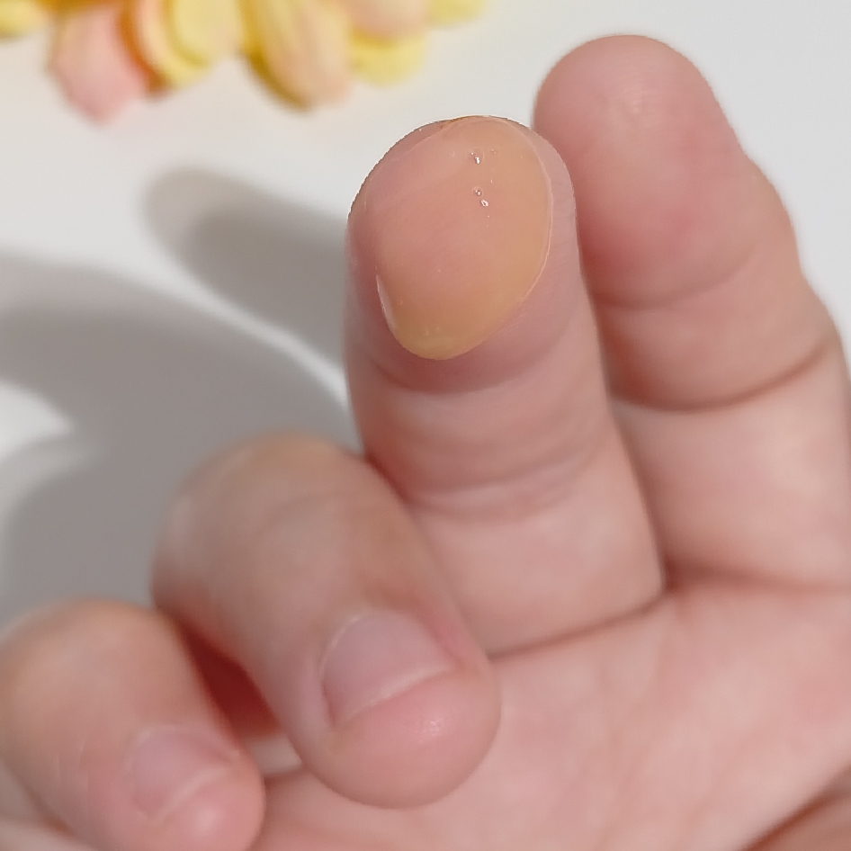 HPR Retinal Serum imgfdn-f5f7675c-ef63-4aa8-b787-a3d4de9463c3