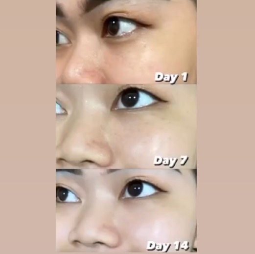 Lift Regenerating Serum imgfdn-b8562d4d-dccc-4645-9250-0c5587381c6a