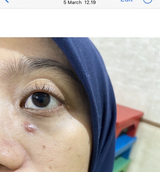 HPR Retinal Serum imgfdn-78863022-57d1-4070-bc3f-a37b95ce8d6b