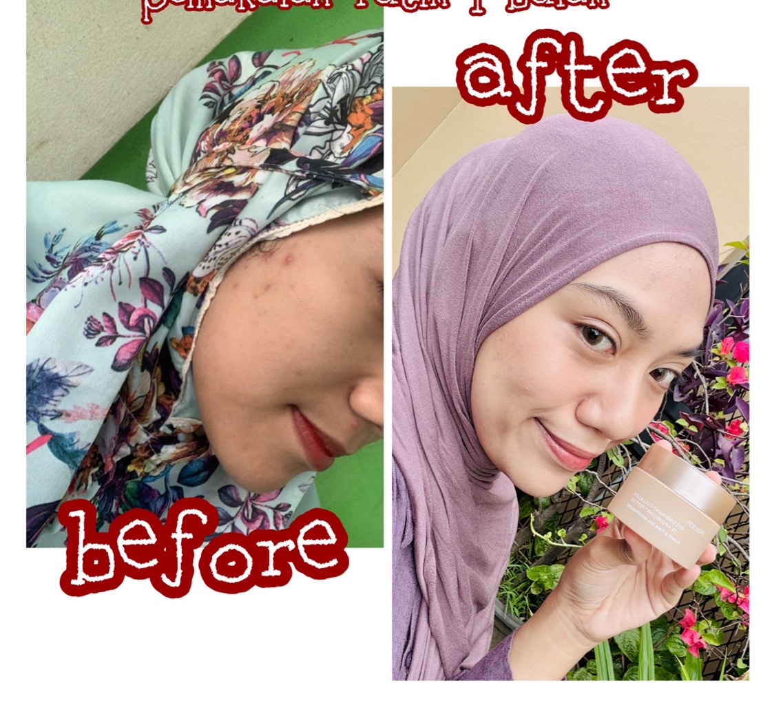 Recombinant Collagen Gel Moisturizer imgfdn-e443aea2-281d-4d1f-8624-f199c03e1a75