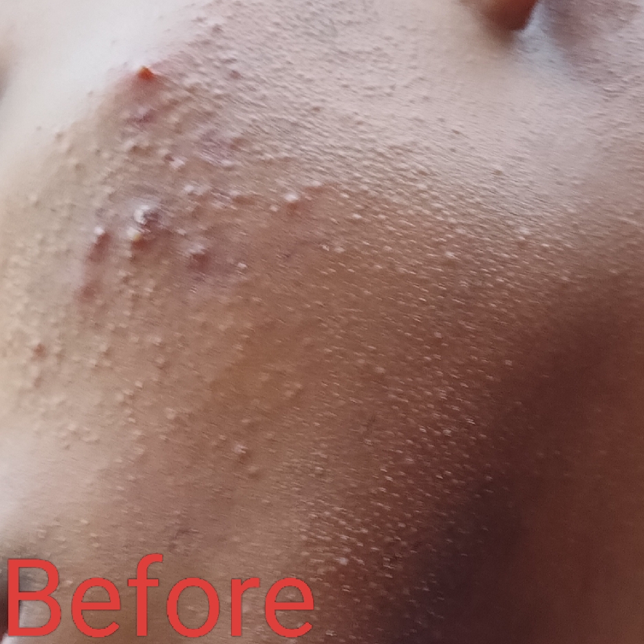 BiomeRepair™ Barrier Revive Cream imgfdn-5d0b03da-6216-4aea-8bbd-3192bd332826