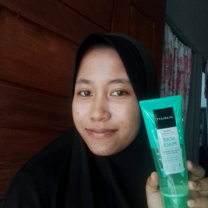 Low pH Acne Peace Gel Cleanser imgfdn-e8453f5e-899f-468d-9a0d-fe9c3dd01a19