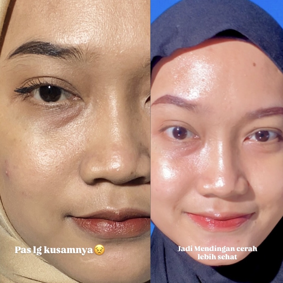 Ultimate Vibrant Skin imgfdn-28561fe2-1279-442e-9d7e-ef934d8d4687