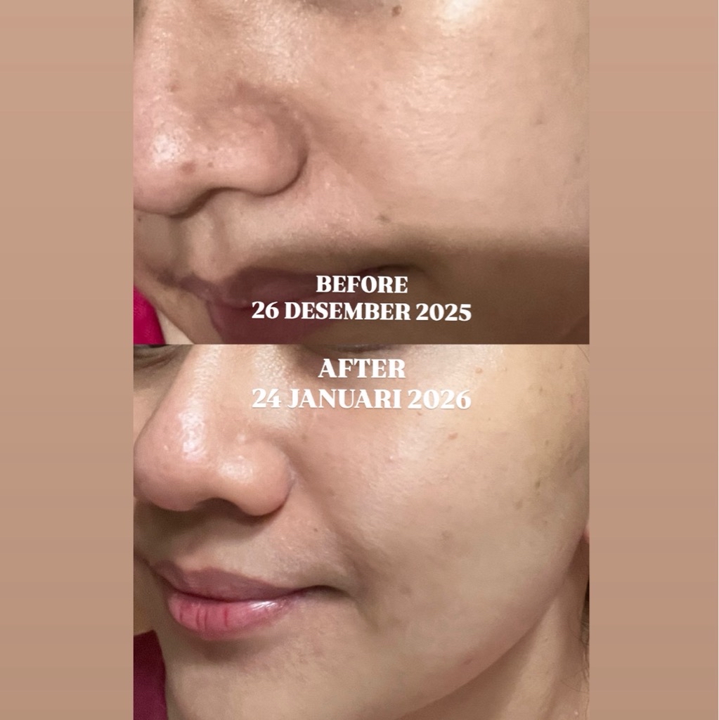 Ultimate Vibrant Skin imgfdn-962f195c-2046-4112-a267-fe3df6d07563