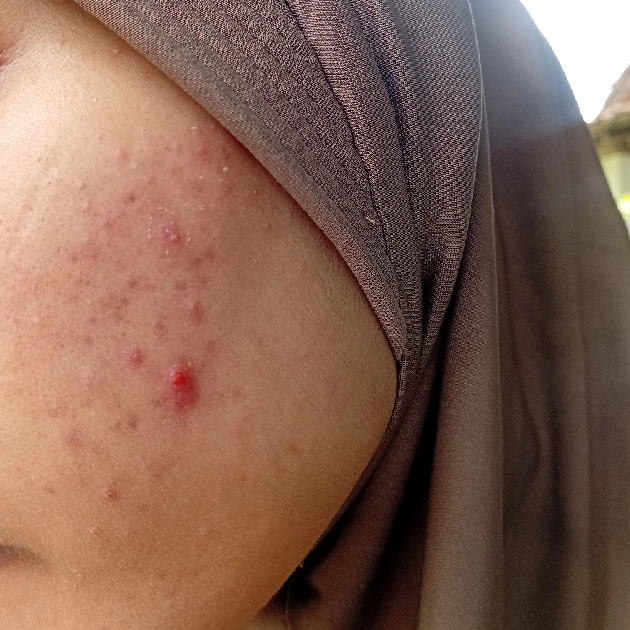 Oil-free Ultra-Moisturizing Lotion (with Birch Sap) imgfdn-d36d2d02-5bd3-4e9c-9af7-3fc02f1ae75f