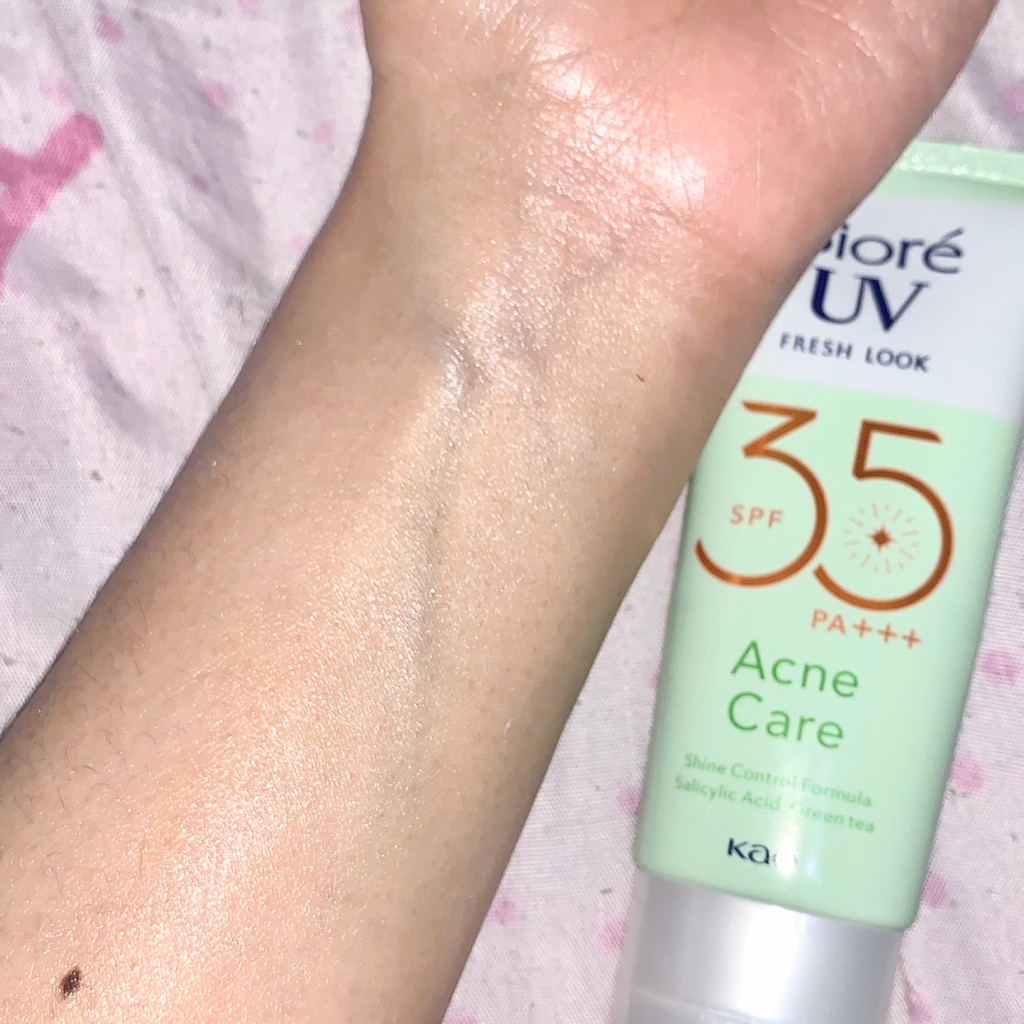 UV Fresh Look Acne Care SPF35  imgfdn-790ba724-8eee-431a-9a9f-5bd4d25ce48f