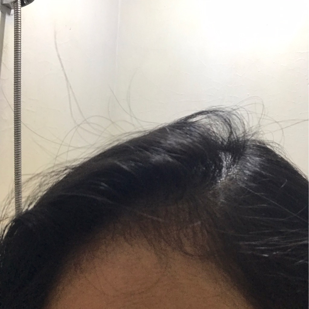 Advisor Hair Repair Anti-Hair Fall Hair & Scalp Tonic imgfdn-34dc7a86-3e45-47da-a73e-bfd8f525f387