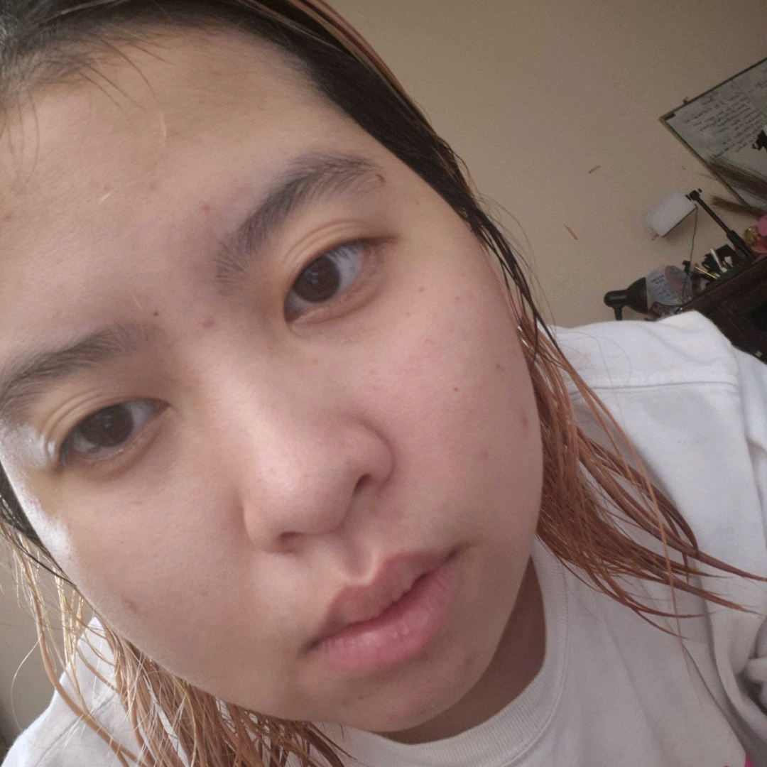 Low pH Acne Peace Gel Cleanser imgfdn-25de14b6-5b8f-4123-95ff-ee926da5c7af