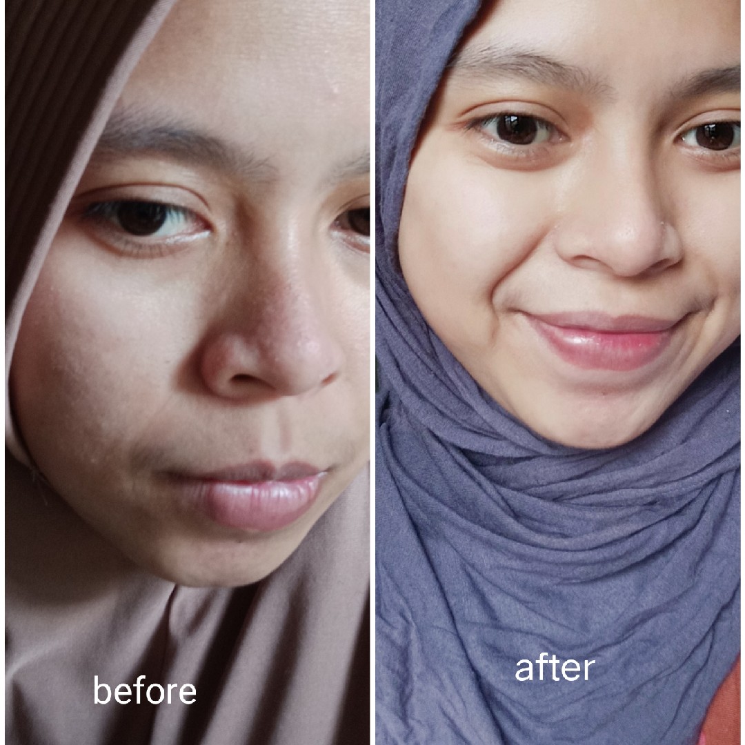 Radiant Resurfacing Retinal Cysteamine Serum imgfdn-8d245172-8d31-4495-b727-a8442696e8d7