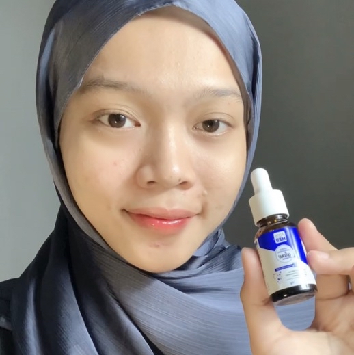 Essential Acne Care Serum imgfdn-4e745ad3-eff8-4178-a259-ea052fe099cb