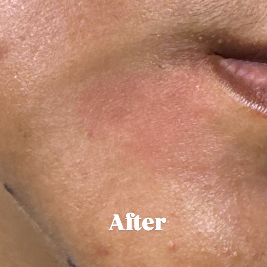 Hydra Miracle Ultra Light Biome Gel imgfdn-64e7b56b-4cde-45b7-b7e2-6ee5ef32c71f