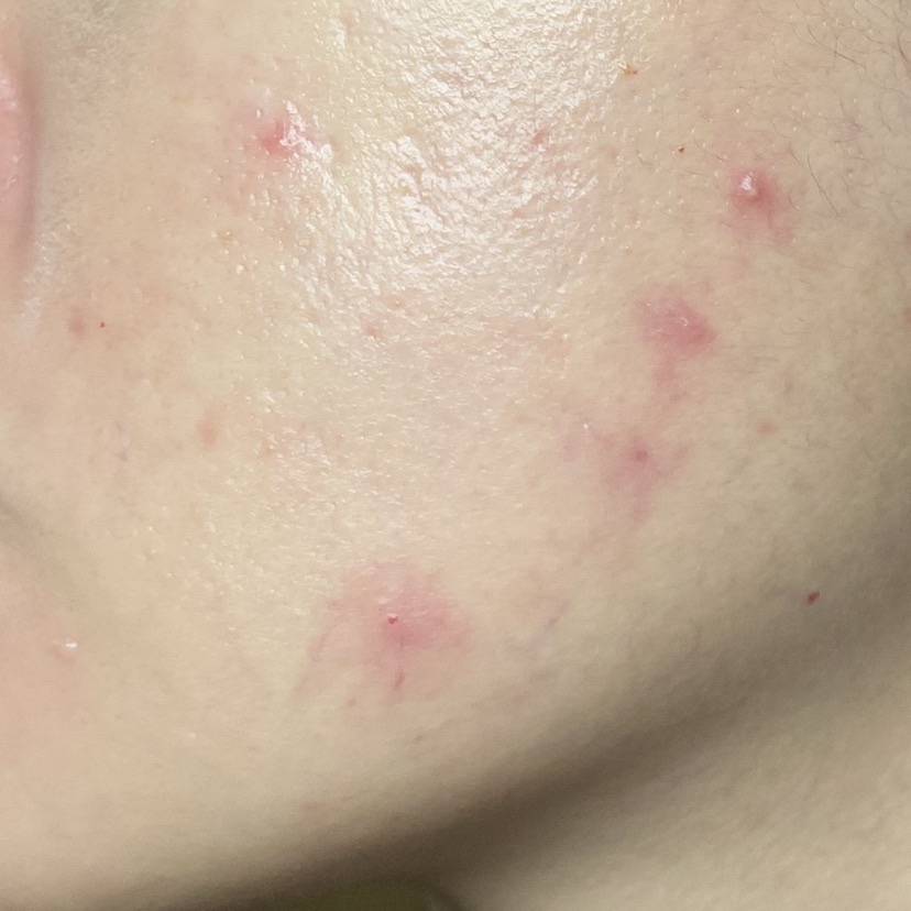Skin Ready Hydrating Booster imgfdn-b9e34d6f-a082-4946-ac69-bca56adebd73