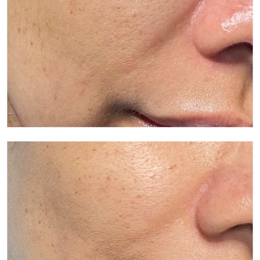 HPR Retinal Serum imgfdn-876d993a-baa9-4867-bc16-2337b6233935