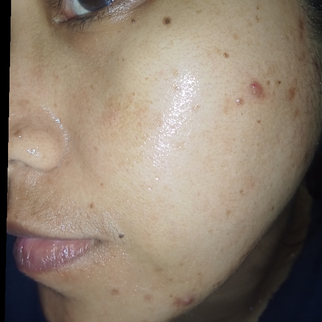 Hyd-rice-ing & Brightening Essence Booster imgfdn-076fde0b-ddf3-431d-8ce8-f3b9f9bcaaee