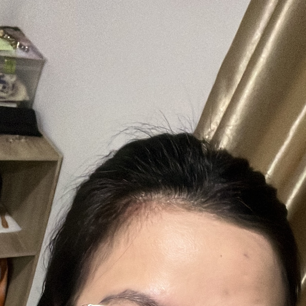 Rosemary Hair Growth Oil imgfdn-614a8e83-09f1-4246-a6f6-d40661a4f932