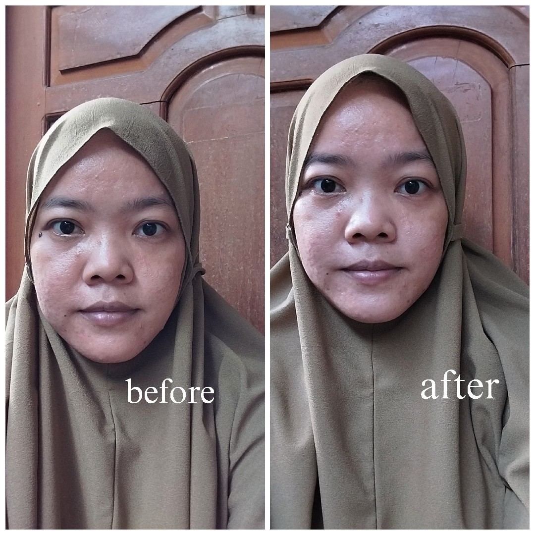 Lift Regenerating Serum imgfdn-221b5fff-1c16-4f38-899f-cf57b987bec4