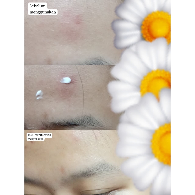 Derma Sensitive Skin Rescue Moisturizer imgfdn-0e10d1f5-3f6d-4d8f-b0a7-502284d0d4c6