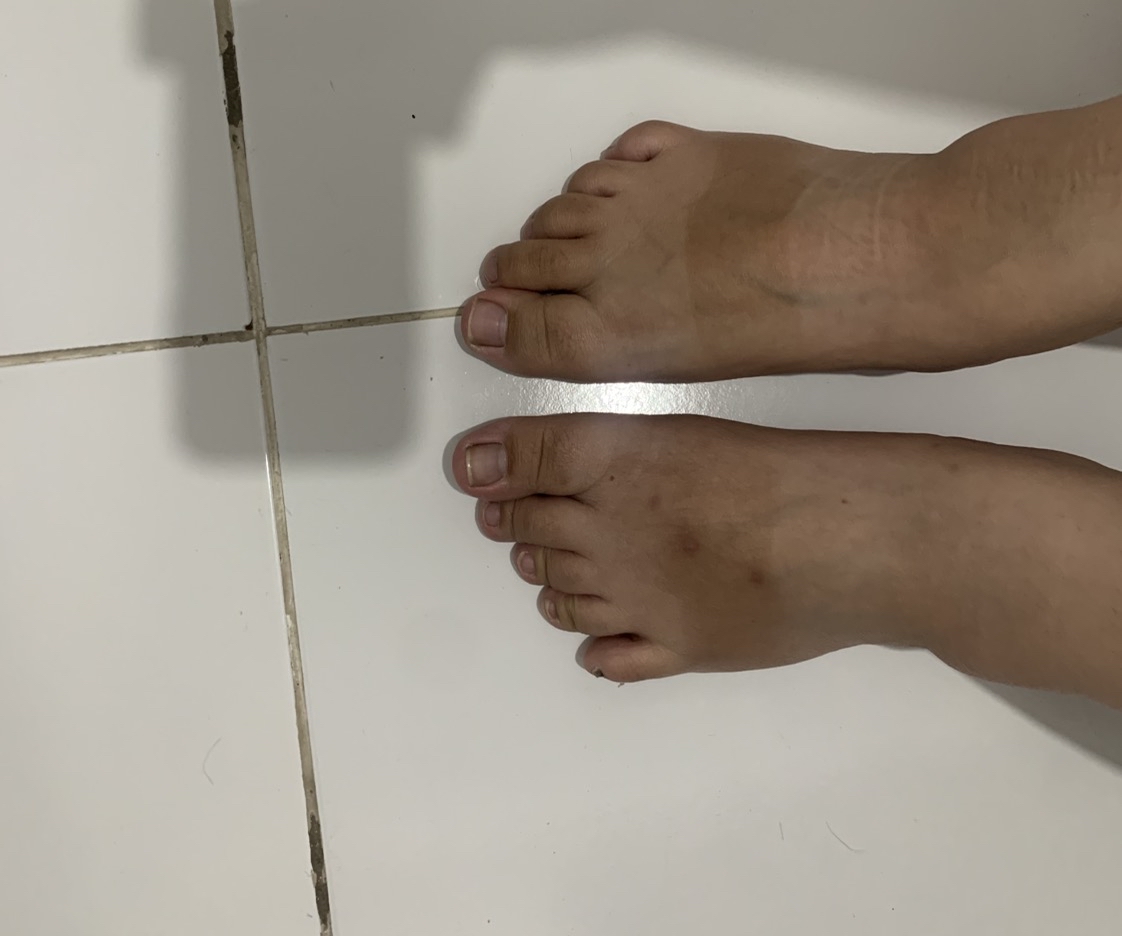 AHA Whitening Body Lotion imgfdn-454c1a21-d975-4784-a62b-ed7b7c59597a