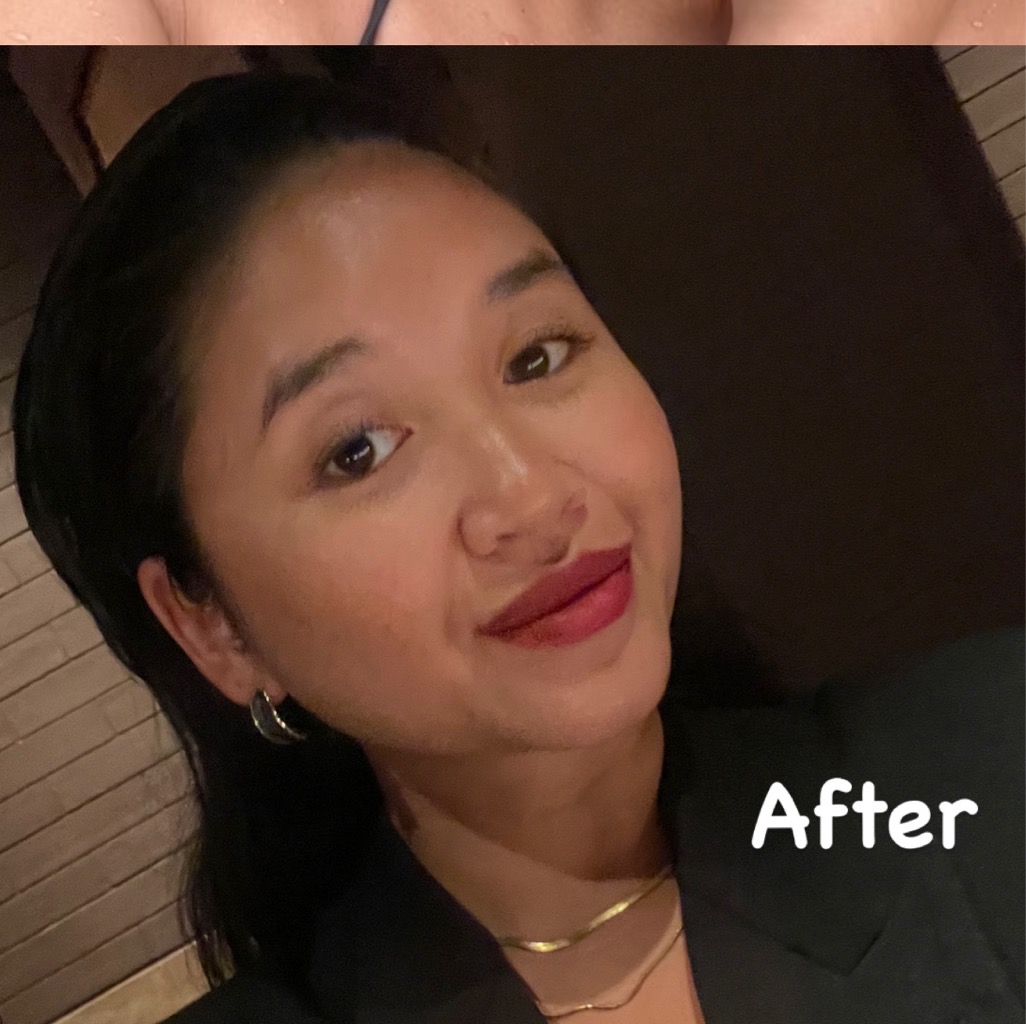 Ultimate Vibrant Skin imgfdn-16b51fe0-fa5f-4868-81e6-a01fab1769e3