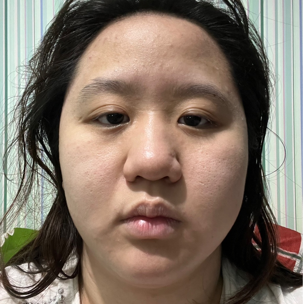 Ultimate Vibrant Skin imgfdn-e7615ad5-2a7f-4240-923b-4692af5999c2