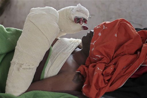 A Bangladeshi man, a victim of one of the recent bomb attacks sparked by the latest clash between the country's two main, long-feuding political factions, lies on a stretcher as he is moved for treatment at a hospital in Dhaka. (Photo: AP) A Bangladeshi man, a victim of one of the recent bomb attacks sparked by the latest clash between the country's two main, long-feuding political factions, lies on a stretcher as he is moved for treatment at a hospital in Dhaka. (Photo: AP)