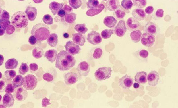 The findings showed that malaria -free mice that received a single dose before being bitten by infected mosquitos were able to avoid developing the disease altogether. (Photo: visualphotos.com) The findings showed that malaria -free mice that received a single dose before being bitten by infected mosquitos were able to avoid developing the disease altogether. (Photo: visualphotos.com)