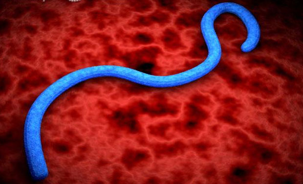 Ebola Virus. (Photo: visualphotos.com) Ebola Virus. (Photo: visualphotos.com)