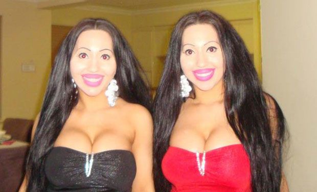 Twin sisters share a boyfriend, undergo $ 200k plastic surgery to look identical. (Photo: AP) Twin sisters share a boyfriend, undergo $ 200k plastic surgery to look identical. (Photo: AP)
