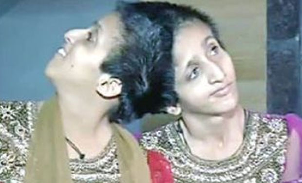 The twins had stopped eating when the verdict on Salman Khan's 2002 hit-and-run case was declared
Photo Credit: ANI The twins had stopped eating when the verdict on Salman Khan's 2002 hit-and-run case was declared
Photo Credit: ANI