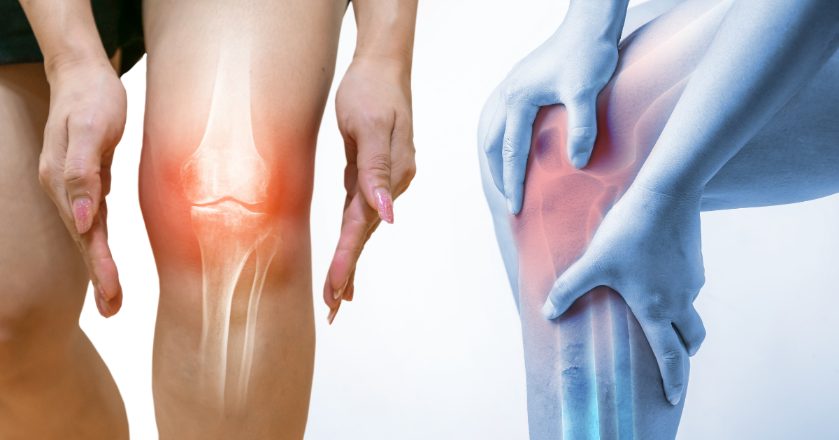orthopedic