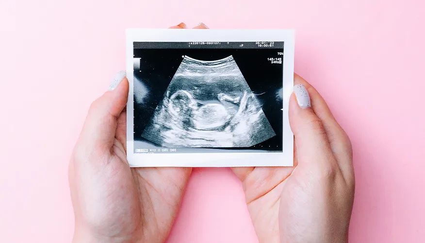 Ultrasound