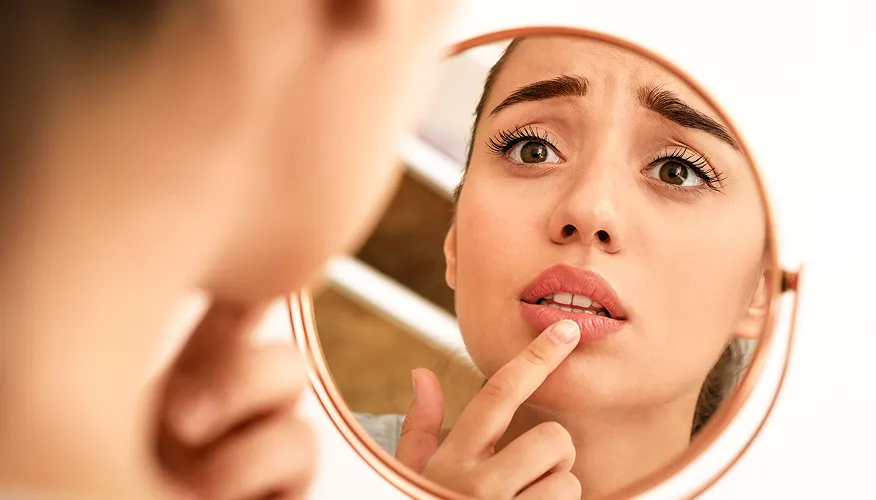 Lip dryness or chapping